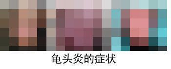 龟头出现红斑怎么回事